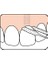 Tepe Bridge & Implant Floss (Diş Ipi) 3