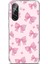 Samsung Galaxy A56 Uyumlu Pembe Fiyonklar Baskılı Silikon Kılıf 1