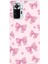 Redmi Note 10 Pro Uyumlu Pembe Fiyonklar Baskılı Silikon Kılıf 1