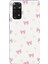 Redmi Note 11 - 11S Uyumlu Fiyonklar ve Pembe Kalpler Baskılı Silikon Kılıf 1