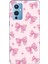 Oneplus 9 Uyumlu Pembe Fiyonklar Baskılı Silikon Kılıf 1