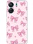 Redmi 13C - Poco C65 Uyumlu Pembe Fiyonklar Baskılı Silikon Kılıf 1