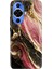 Huawei Nova 12S Kılıf Desenli Kapak Renkli Tpu Uv Seattle Mermer 1