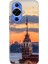 Huawei Nova 12S Kılıf Desenli Kapak Renkli Tpu Uv Kız Kulesi 1
