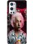 Oneplus 9 Pro Kılıf Desenli Design Silikon Albert 1