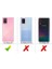 Zore By Conners Galaxy A71 Mat Siyah Silikon + 2 Adet Cam Ekran Koruyucu 1