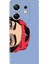 Infinix Zero 30 4g Kılıf Desenli Baskılı Tpu Rubber Kapak Girl 1