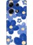 Infinix Note 30 Pro Kılıf Desenli Baskılı Tpu Rubber Kapak Blue Orgin 1