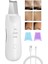 Ultrasonik Yüz Temizleme Cihazı Scrubber | Siyah Nokta Akne Peeling Lifting Nemlendirme Aleti 1