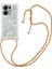 Xiaomi Redmi Note 13 Pro 4g Glitter Ayarlanabilir Kordon Darbeye Dayanıklı Durumda (Yurt Dışından) 1