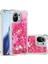 Xiaomi Mi 11 Glitter Sparkle Sevimli Sıvı Akan Tpu Için Telefon Kılıfı (Yurt Dışından) 5