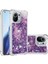 Xiaomi Mi 11 Glitter Sparkle Sevimli Sıvı Akan Tpu Için Telefon Kılıfı (Yurt Dışından) 3
