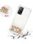 Xiaomi 10T/10T Pro Tpu Koruyucu Quicksand Glitter Sparkle Için Telefon Kılıfı (Yurt Dışından) 3