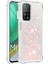 Xiaomi 10T/10T Pro Tpu Koruyucu Quicksand Glitter Sparkle Için Telefon Kılıfı (Yurt Dışından) 1
