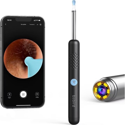 Bebird R1 Akıllı Kulak Temizleme Cihazı Kameralı Otoskop – Siyah