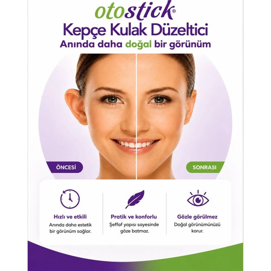 Otostick Yetişkin (Kozmetik Kepçe Kulak Düzeltici Bant) Tekli Paket