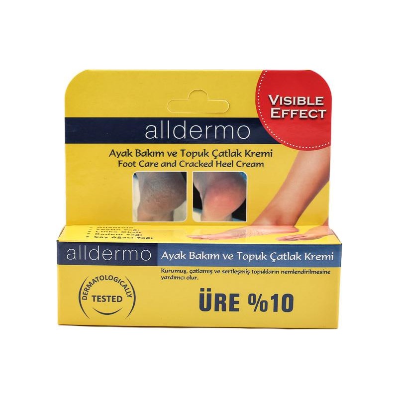 Alldermo 60 g Ayak-Topuk Bakım Kremi Kuru Ve Çatlak Topuklar İçin Hızlı Sonuç