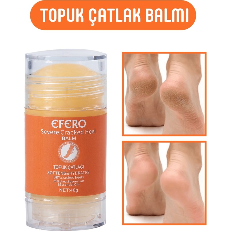 TBY Shop Kuru Ve Yıpranmış Ayaklar & Topuklar İçin Ayak Ve Topuk Kremi 40G