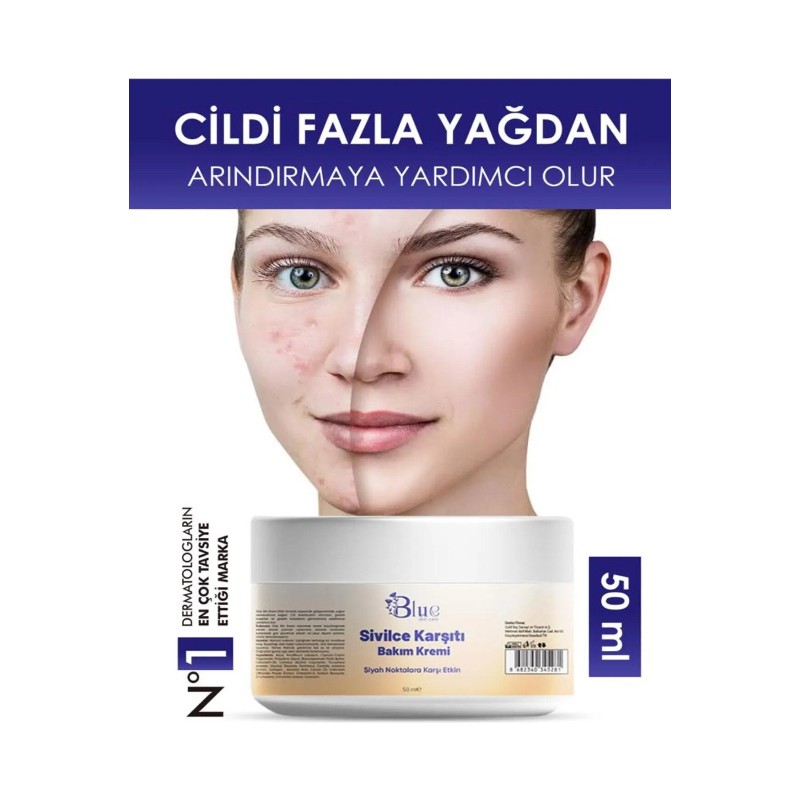 Blue Skin Care Yüz Kremi sivilce Karşiti Akne temizleme Tüm Cilt Tipleri Için 50ML