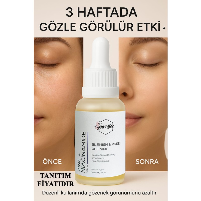 Giroflee Zinc + Niacinamide Serum 30 ml – Gözenek Sıkılaştırıcı, Sivilce ve Leke Karşıtı Serum