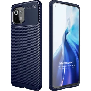 Xiaomi Mi 11 Lite Kılıf Legion Series Lacivert