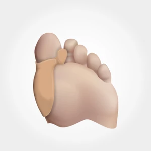Bunion Koruyuculu Parmak Arası Makara 831