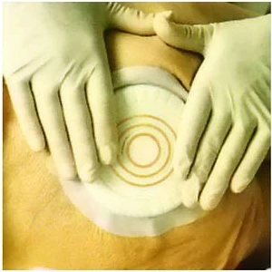 10 Adet Coloplast 33353 Comfeel Plus Basınç ıcı Hidrokolloid Yara Örtüsü 10 cm