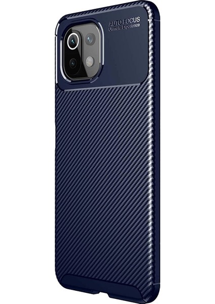 Xiaomi Mi 11 Lite Kılıf Legion Series Lacivert