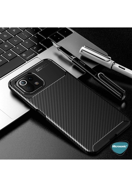 Xiaomi Mi 11 Lite Kılıf Legion Series Lacivert