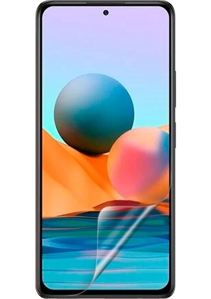 Caseworld Xiaomi Redmi Note 10 Pro Nano Ekran Koruyucu Kırılmaz Esnek Cam