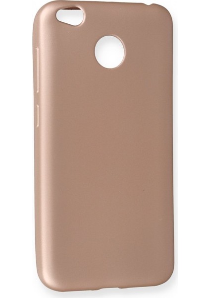Xiaomi Redmi 4x Kılıf Yumuşak Dokulu Silikon + Ekran Koruyucu Cam Rose Gold