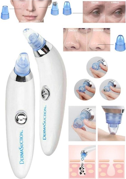 Dermasuction Derma Suction Vakumlu Siyah Nokta Temizleme Cihazı Pil Ile Çalışır