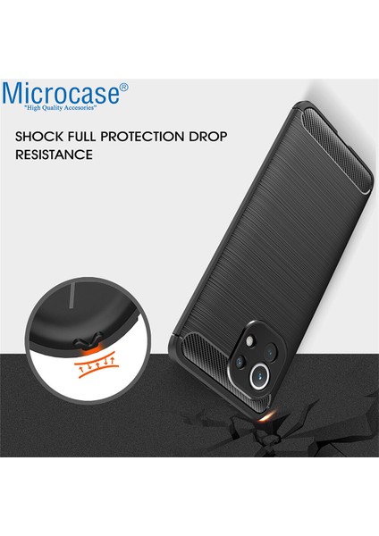 Xiaomi Mi 11 Youth Brushed Carbon Fiber Silikon Kılıf - Siyah fiyatları