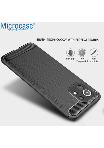 Xiaomi Mi 11 Youth Brushed Carbon Fiber Silikon Kılıf - Siyah modelleri