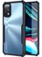 Realme 7 Pro Airbag Serisi Darbeye Dayanıklı Tpu Kılıf 1