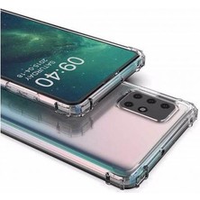 Maycase Aksesuar Samsung Galaxy A71 Antişok Airbag Şeffaf Kılıf