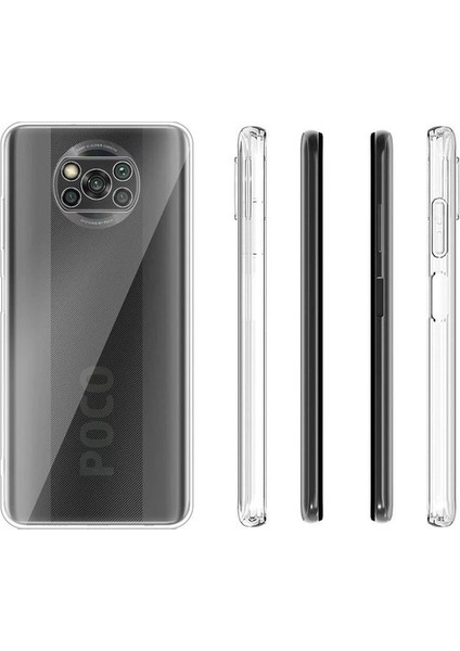 Xiaomi Poco X3 Pro Kılıf Kamera Korumalı Tıpalı Silikon Şeffaf