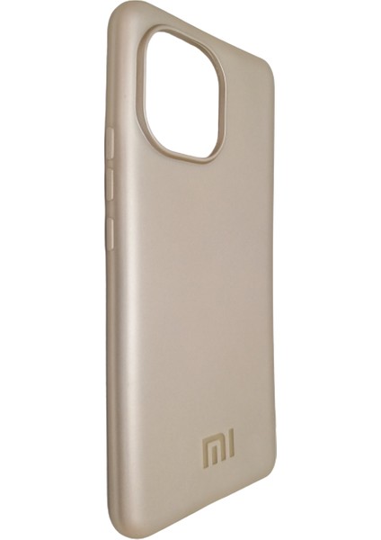 Xiaomi Mi 11 Ince Kalıp Kamera Çıkıntılı Silikon Kılıf