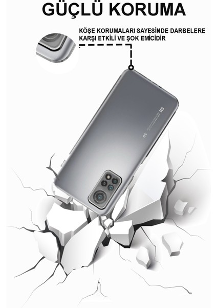 CaseWorld Xiaomi Mi 10T Silikon Kılıf Kamera Korumalı Tıpalı Şeffaf Kapak modelleri