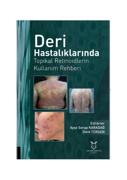 deri Hastalıklarında Topikal Retinoidlerin Kullanım Rehberi - Ayşe Serap Karadağ