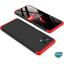 Microsonic Xiaomi Mi 11 Lite Kılıf Double Dip 360 Protective Siyah