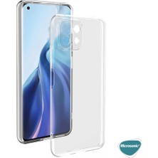 Microsonic Xiaomi Mi 11 Lite Kılıf Transparent Soft Beyaz