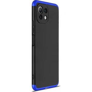 Xiaomi Mi 11 Lite Kılıf Double Dip 360 Protective Siyah Mavi
