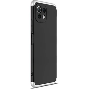 Xiaomi Mi 11 Lite Kılıf Double Dip 360 Protective Siyah Gri