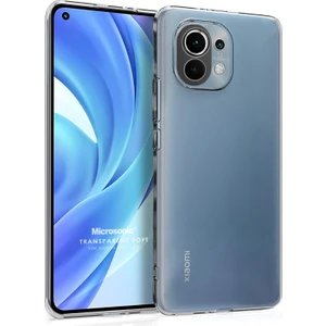 Xiaomi Mi 11 Lite Kılıf Transparent Soft Beyaz