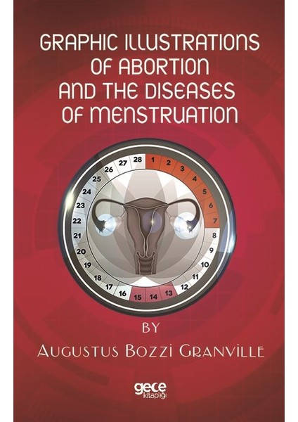 Graphic Illustratıons Of Abortıon And The Dıseases Of Menstruatıon - Augustus Bozzı Granvılle