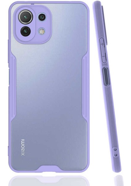 Xiaomi Mi 11 Lite Kılıf Kenar Renkli Kamera Korumalı Mat Kapak Mor