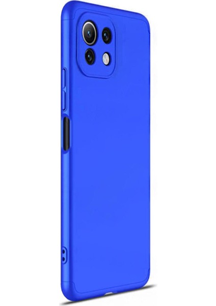 Xiaomi Mi 11 Lite Kılıf Double Dip 360 Protective Mavi