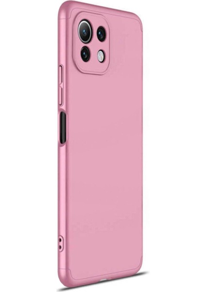 Xiaomi Mi 11 Lite Kılıf Double Dip 360 Protective Rose Gold