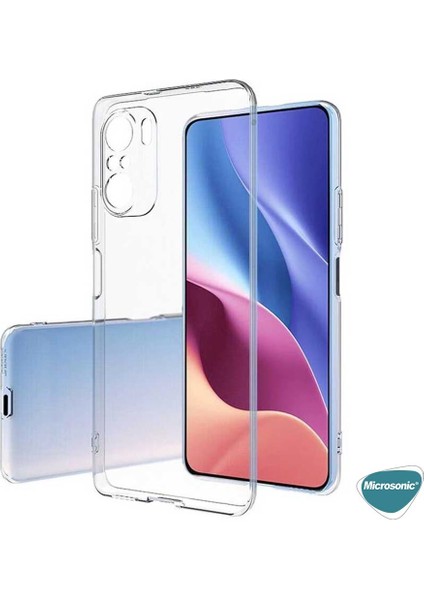 Xiaomi Redmi Note 10 Kılıf Transparent Soft Beyaz